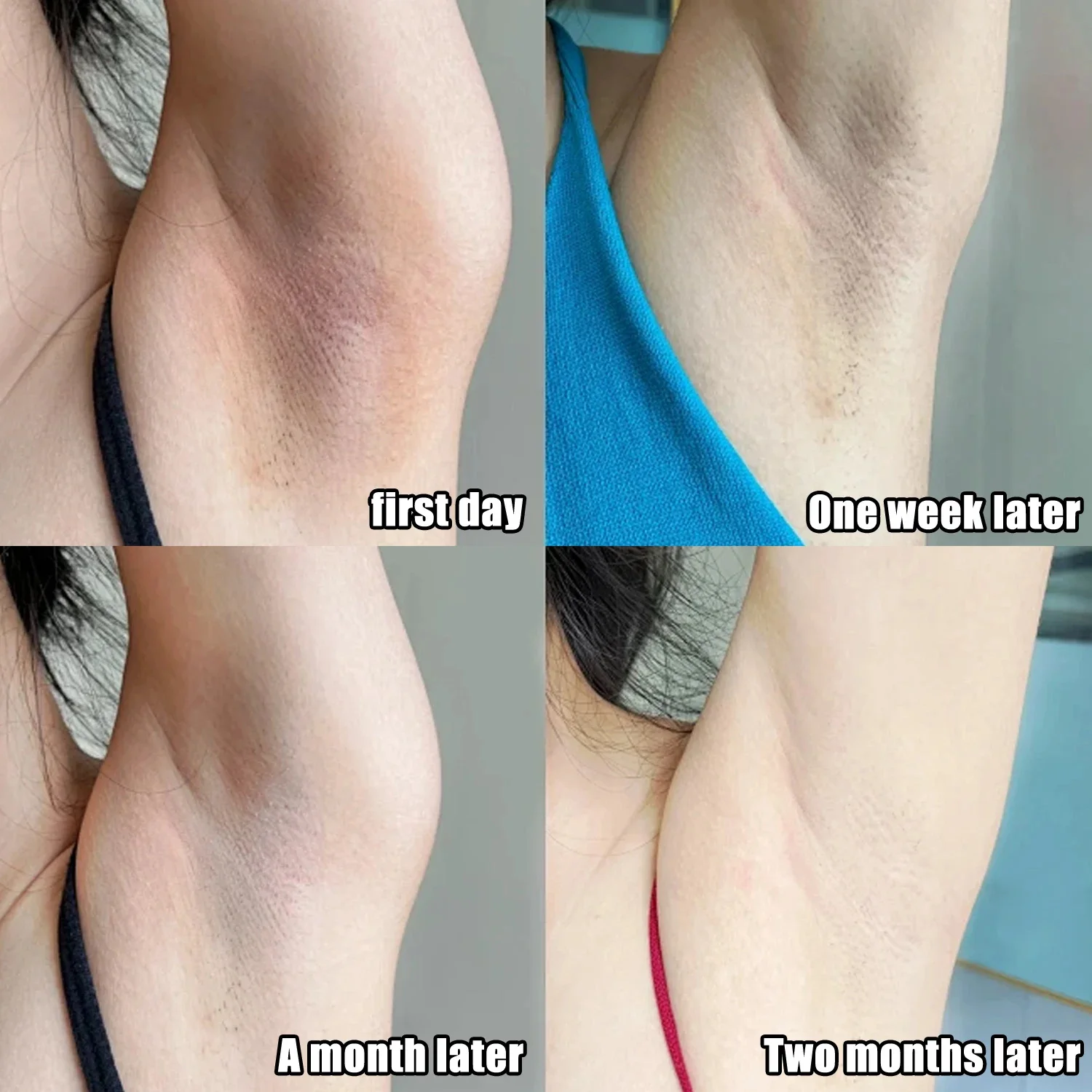 Collagen underarm whitening cr – Anti-Aging Face Cream Bewertung und Preis