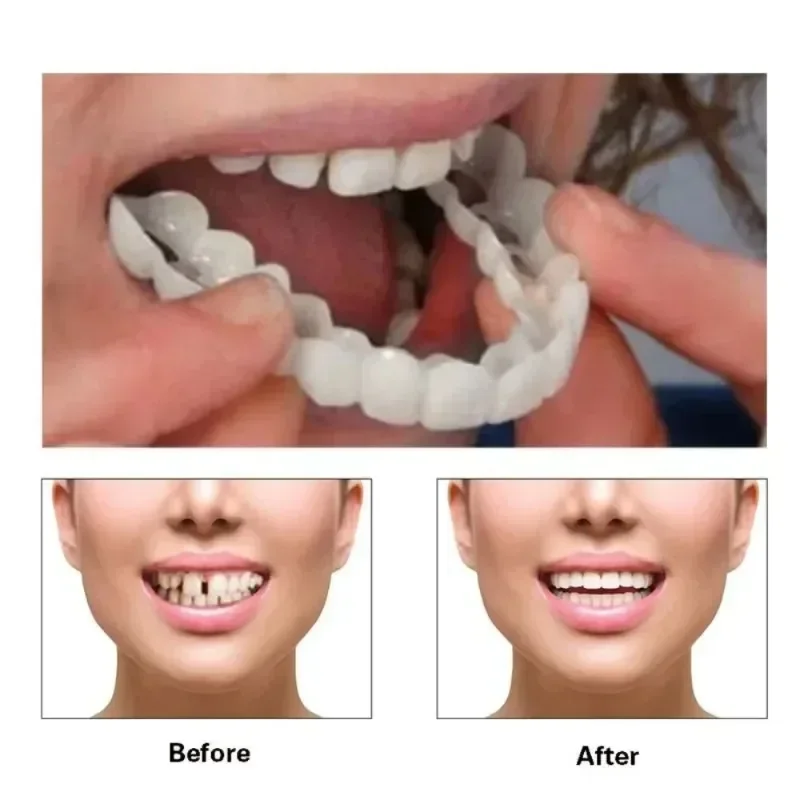 Fake Tooth Cover Perfect Fit T – Beauty Makeup News Bewertung und Preis