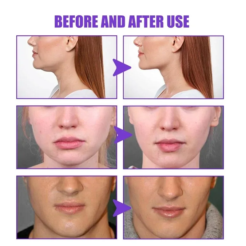 Face-lift Slimming Cream Slimm – Anti-Aging Face Cream Bewertung und Preis