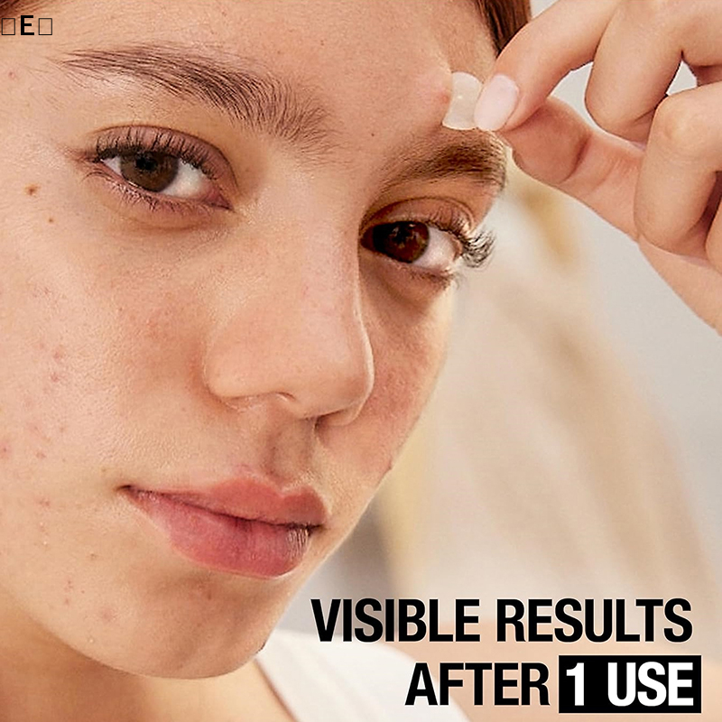〔E〕360Pcs Invisible Pimple Rem – Beauty Zone Makeup Bewertung und Preis